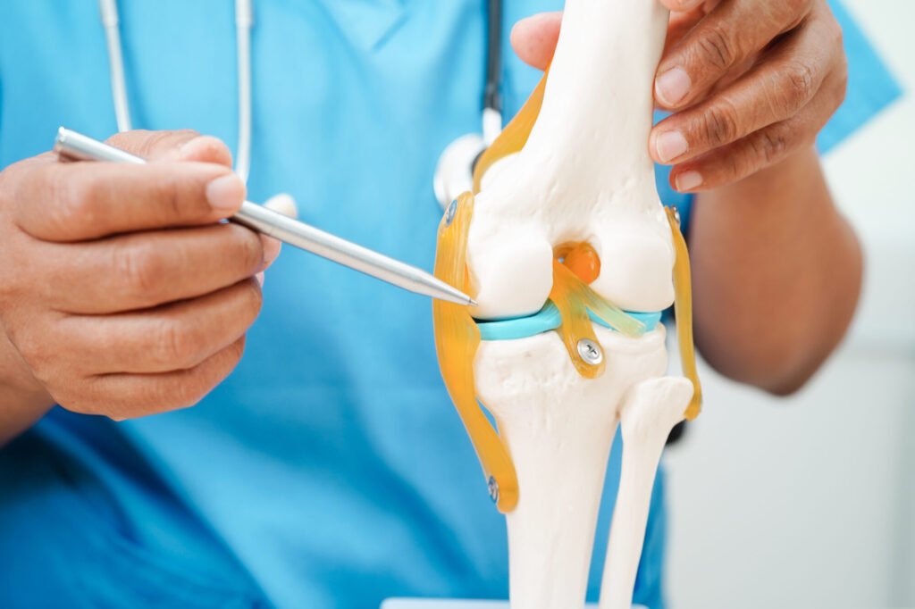 Joint Replacement Solutions